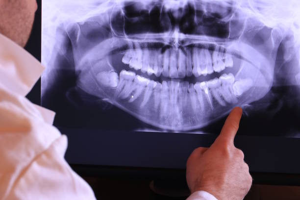Best Emergency Denture Repair in Lake Alfred, FL